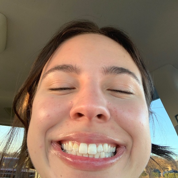 Meet your Posher, Hope - Picture 7 of 8